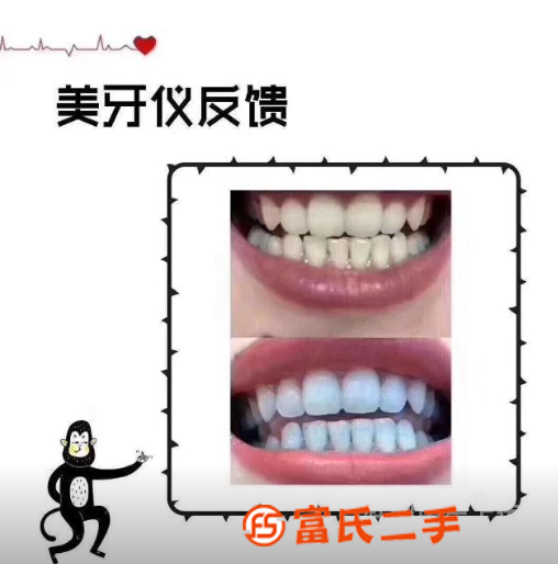 用碧緹福美牙儀牙齒白了，涂都漂亮了