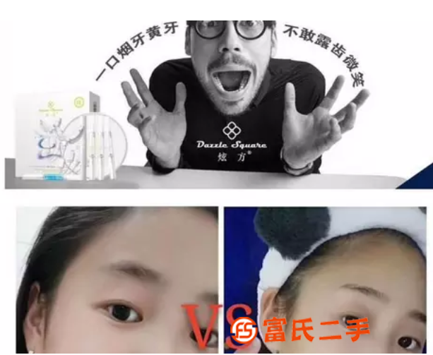 牙齒美白儀牌子好